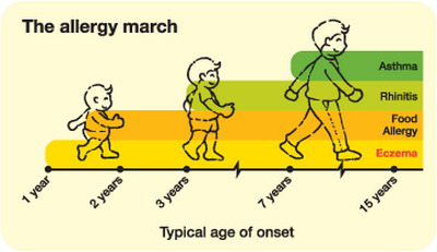 Tình trạng dị ứng ở trẻ em có thể được cải thiện với một số loại thực phẩm, khi hệ tiêu hóa của chúng phát triển hoàn chỉnh, còn với người lớn, lỡ dính thứ nào, thì coi như dính luôn